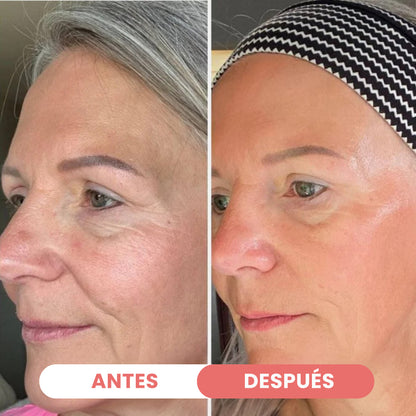 PACK Mascarillas de biocolágeno