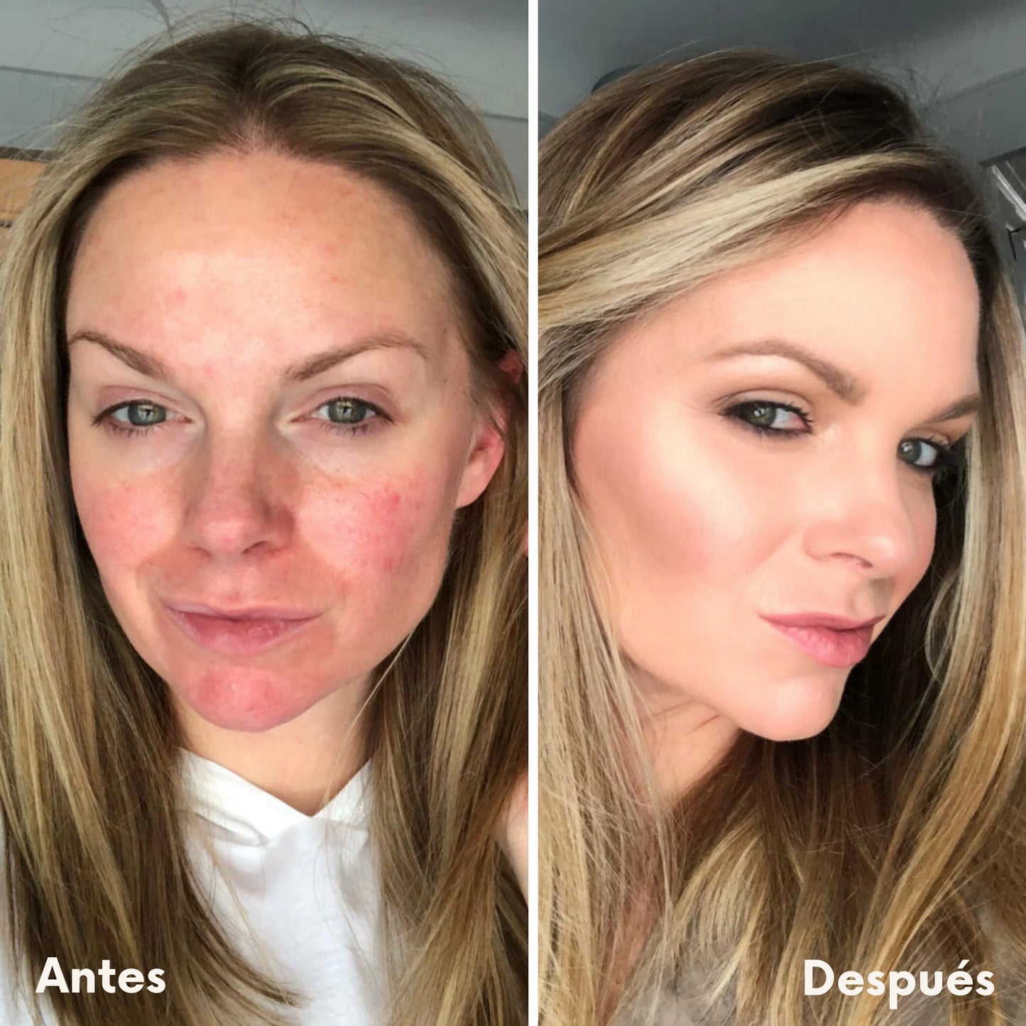 Base de Maquillaje Antiedad con SPF 50 – Se Adapta a tu Tono de Piel