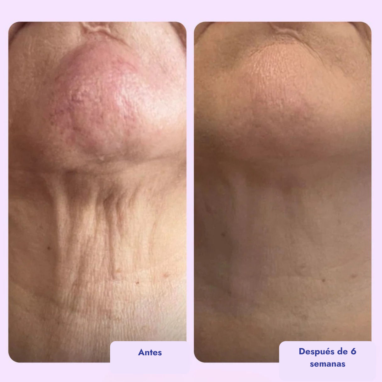 Crema reafirmante y tonificante para el cuello