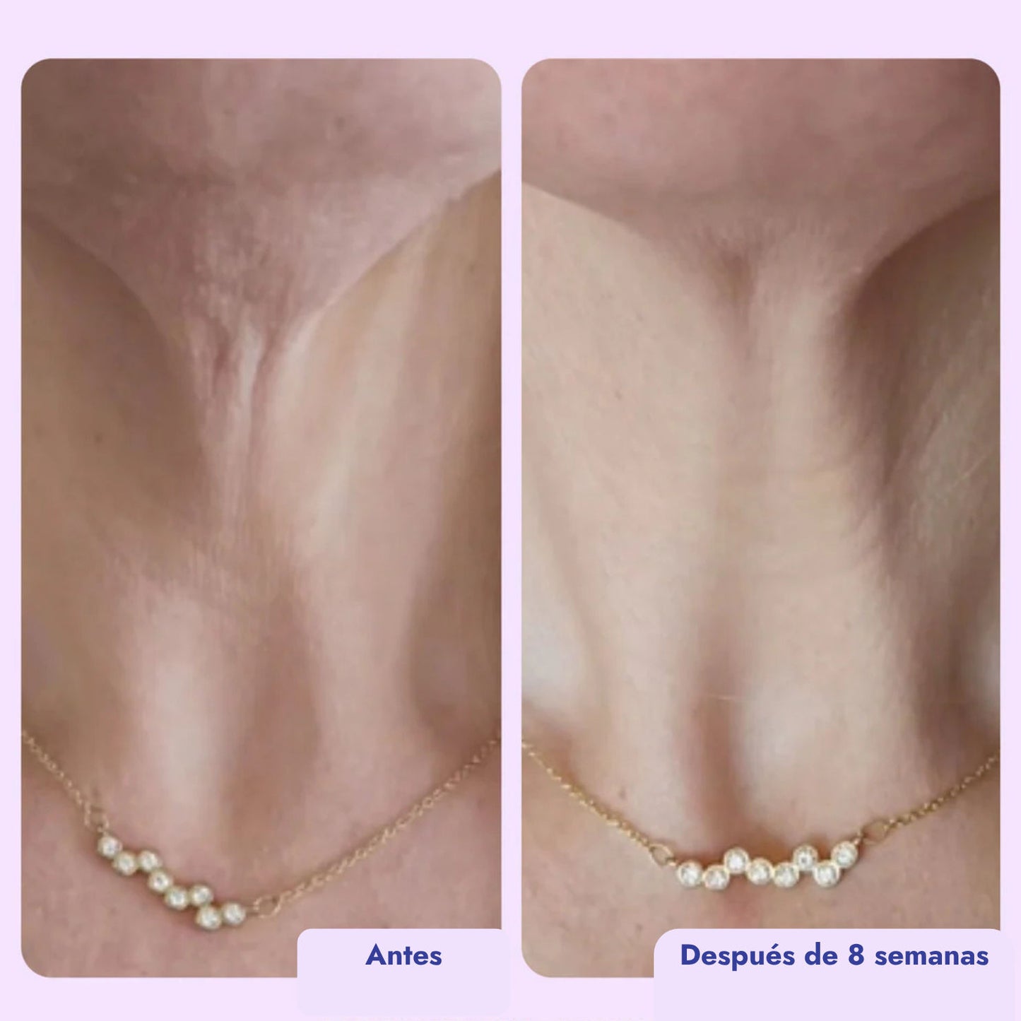 Crema reafirmante y tonificante para el cuello
