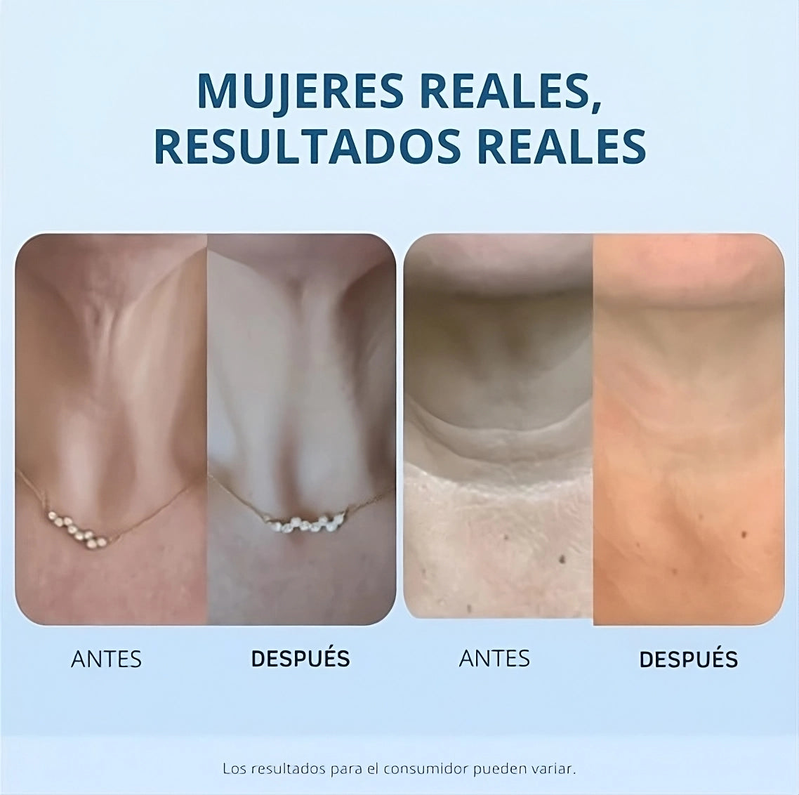 Tighten y Lift™ - Crema Reafirmante de cuello y escote