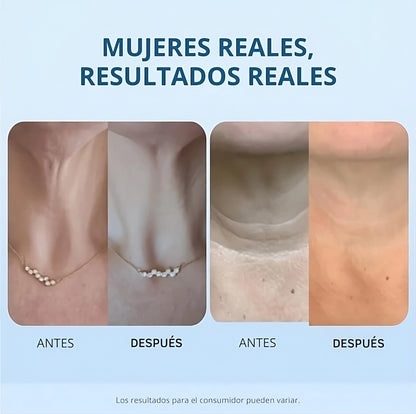 Tighten y Lift™ - Crema Reafirmante de cuello y escote